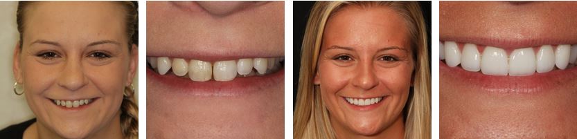 Dentist in New York City Smile Gallery Case