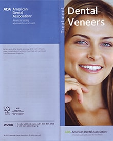 John Nosti Media File Dental Veneers Cover