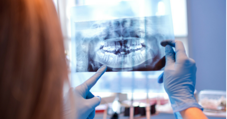 Doctor Holding X-Ray of Mouth