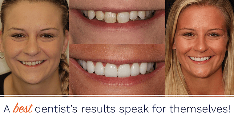 A best dentist's results speak for themselves!